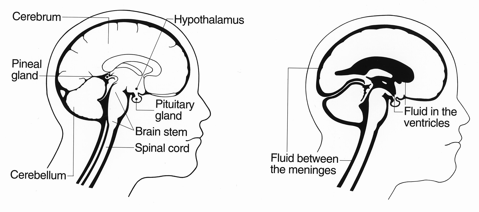 A medical illustration of the human brain